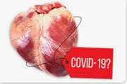 Evaluating the Impact of COVID-19 Pandemic on Organ Donation and Transplantation Activities in Iran