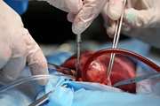 The role of healthcare professionals to improve organ donation and transplantation outcome a national study 