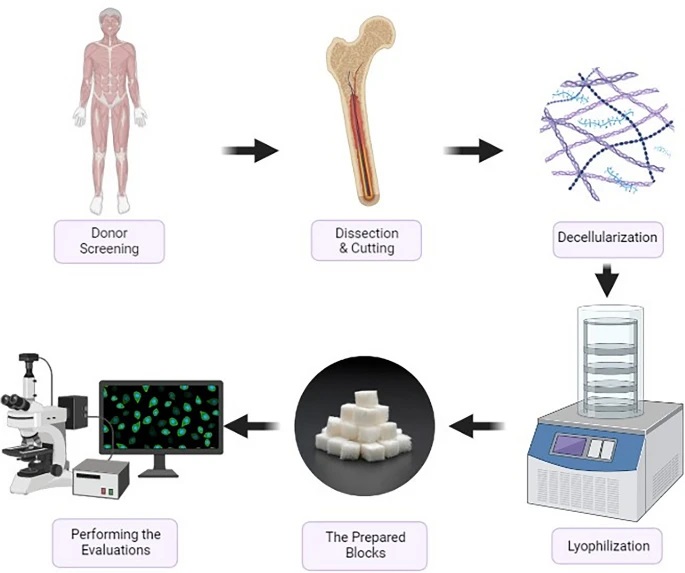 The potential of the mineralized bone allograft block as an appropriate candidate for bone tissue engineering in periodontology